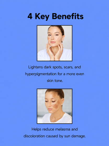 Achetez 2 Kojie San 3×100 g et recevez 1 crème pour le visage Kojie San gratuite – Ensemble Verhelderende &amp;amp; Hydraterende – Vermindert Donkere Vlekken, Egaliseert de Huidtint &amp;amp; Hydrateert Intensief – Voor een Gladde, Stralende &amp;amp; Gezonde Huid