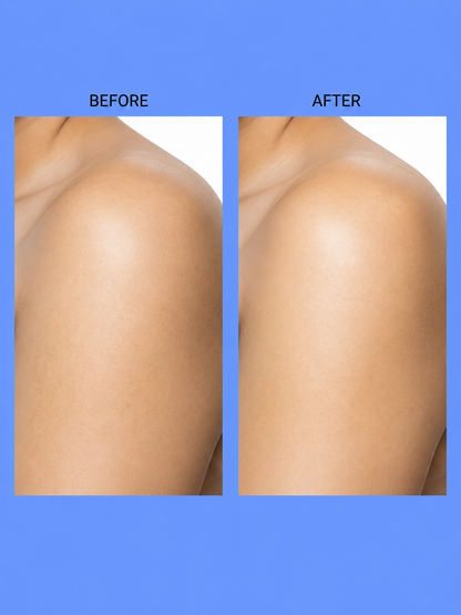 Belo Body Advantage Package – Verhelderende &amp;amp; Hydraterende Body Care Set – Helpt Donkere Vlekken te verminderen, Egaliseert de Huidtint &amp;amp; Voedt Intensief – Voor een Gladde, Stralende &amp;amp; Gezonde Huid