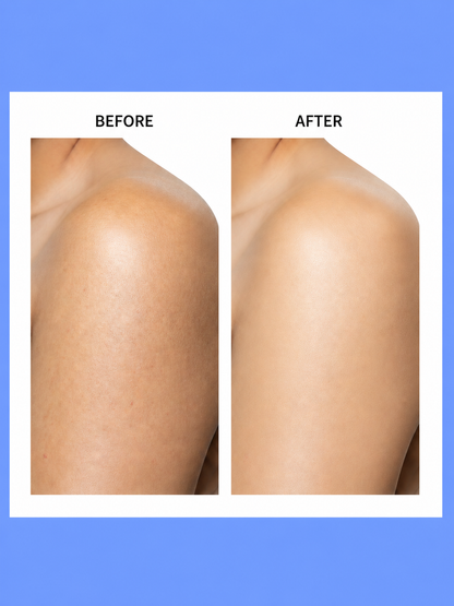 Belo Intensive Whitening Micropeeling Toner + Extra Moisture Soap – Verhelderende &amp; Hydraterende Huidverzorgingsset – Exfolieert, Egaliseert de Huidtint &amp; Hydrateert Intensief – Voor een Gladde, Stralende &amp; Gezonde Huid