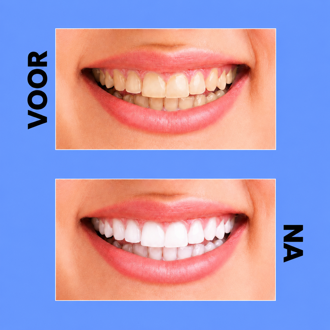 Crest 3D Brilliance White Tandpasta – 121 g (2 stuks) – Geavanceerde Whitening Tandpasta – Verwijdert Oppervlaktevlekken, Verhelderde Tanden &amp;amp; Zorgt voor een Stralend Witte, Gezonde Glimlach