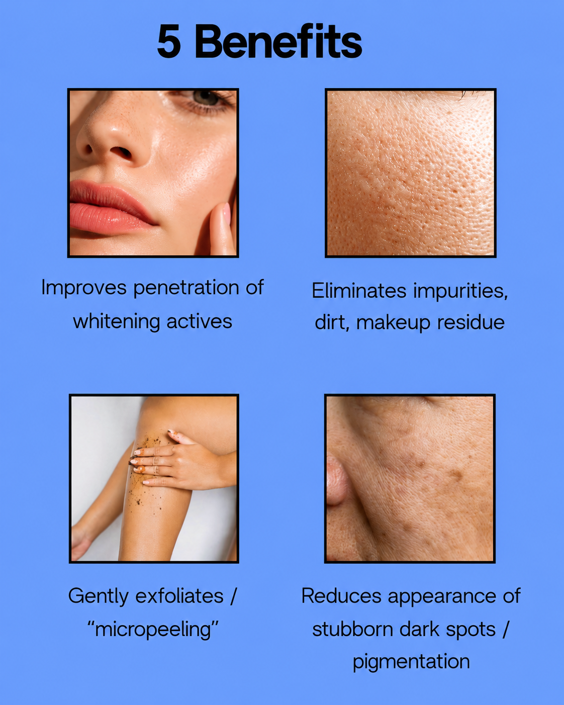 White Korea Facial Wash Acne+ Cleanse &amp;amp; Prevent – ​​100 ml – Diep Reinigende &amp;amp; Acne-Bestrijdende Gezichtsreiniger – Verwijdert Onzuiverheden, Voorkomt Puistjes &amp;amp; Geeft een Frisse, Gladde &amp;amp; Gezonde Huid