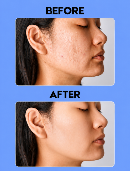 Alada Skin Lightening Zeep – 160g – Tegen Pigmentvlekken – Donkere Vlekken Verwijderaar – Egale Huid – Whitening Gezichts- &amp;amp; Lichaamszeep – Natuurlijke Ingrediënten – Hydraterend &amp;amp; Verzorgend