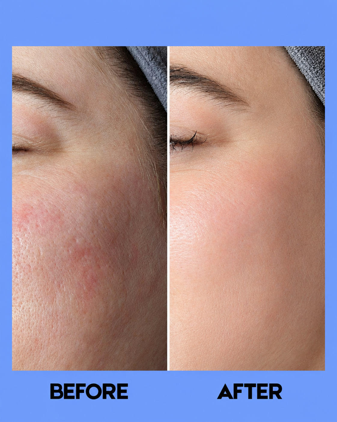 RDL Babyface Astringent Solution Care – Tonique professionnel pour personnes âgées et femmes – Nettoyage intensif et nettoyage du visage – Balans, frisses hydratantes et anti-gland – Nettoyage de l&