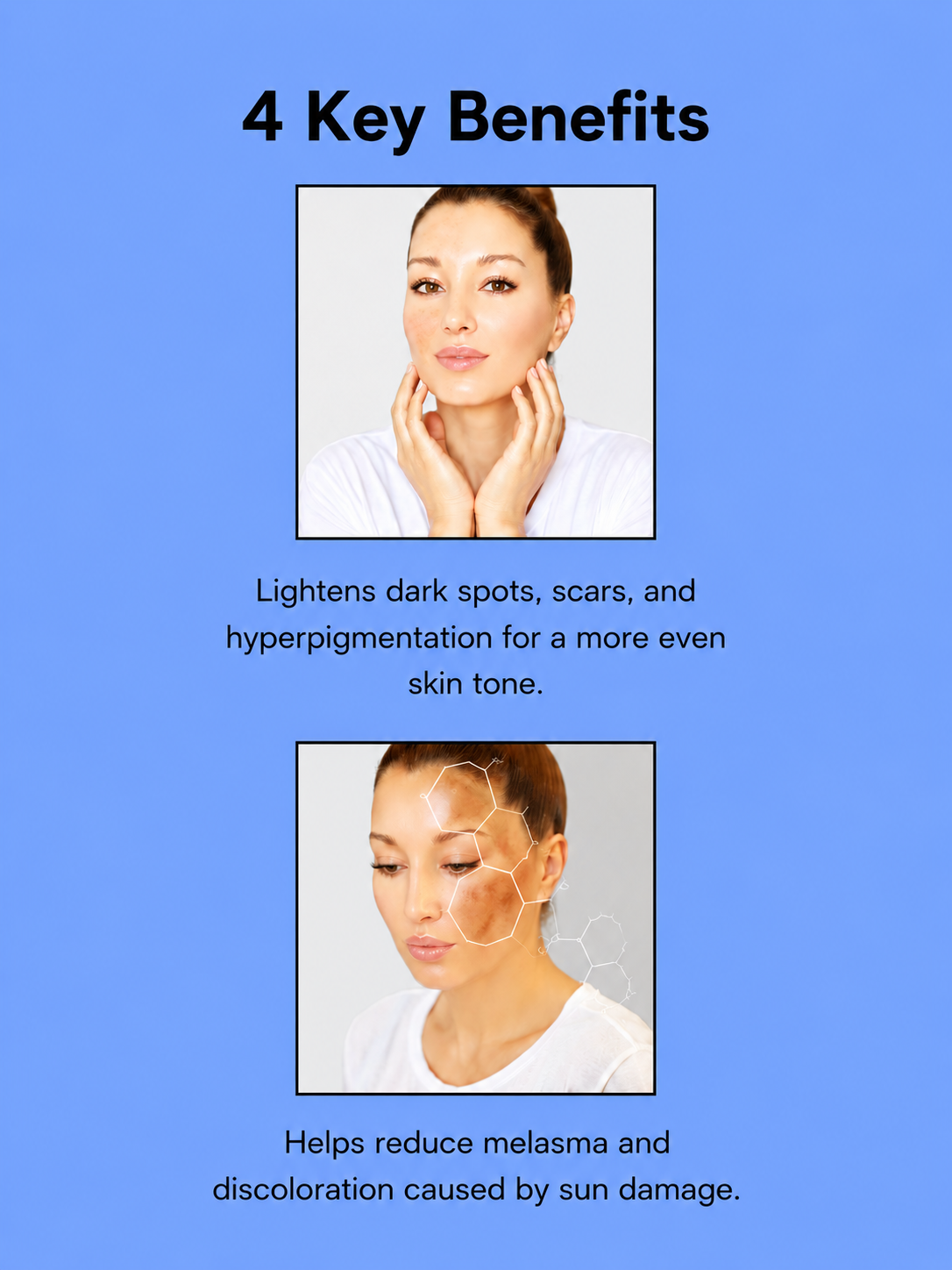 Kojie San Skin Lightening Zeep – 3×65 g – Verhelderende &amp;amp; Hydraterende Zeepset – Helpt Donkere Vlekken te verminderen, Egaliseert de Huidtint &amp;amp; Hydrateert Intensief – Voor een Gladde, Stralende &amp;amp; Gezonde Huid