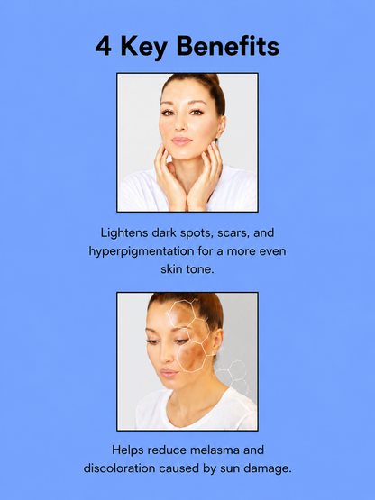 Kojie San Skin Lightening Zeep – 3×65 g – Verhelderende &amp;amp; Hydraterende Zeepset – Helpt Donkere Vlekken te verminderen, Egaliseert de Huidtint &amp;amp; Hydrateert Intensief – Voor een Gladde, Stralende &amp;amp; Gezonde Huid
