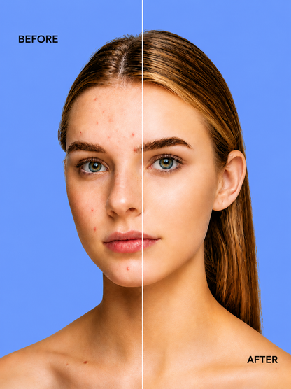 Kojie San Skin Lightening Zeep – 3×65 g – Verhelderende &amp;amp; Hydraterende Zeepset – Helpt Donkere Vlekken te verminderen, Egaliseert de Huidtint &amp;amp; Hydrateert Intensief – Voor een Gladde, Stralende &amp;amp; Gezonde Huid