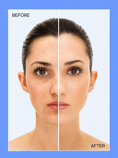 Kojie San Niacinamide Soap – Verhelderende &amp;amp; Reinigende Zeep – Verrijkt met Niacinamide om Donkere Vlekken te Verminderen, de Huidtint te Egaliseren &amp;amp; de Huid te Verzachten – Voor een Stralende, Gladde &amp;amp; Gezonde Huid