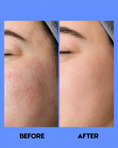 Tonique éclaircissant pour la peau Gluta-C 100 ml