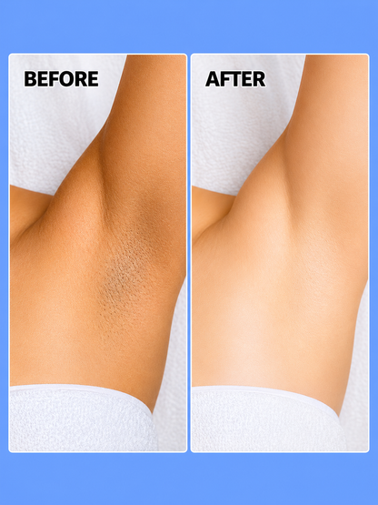 Belo Underarm Whitening Cream – 10 g – Verhelderende &amp; Verzachtende Okselcrème – Helpt Donkere Vlekken te Verminderen, Egaliseert de Huidtint &amp; Hydrateert – Voor Zachte, Stralende &amp; Gezonde Okselhuid